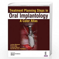 Treatment Planning Steps In Oral Implantology:A Color Atlas by LANKA MAHESH Book-9789352700592
