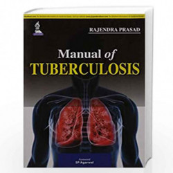 Manual Of Tuberculosis by PRASAD RAJENDRA Book-9789351522225