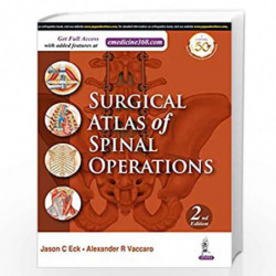 Surgical Atlas of Spinal Operations by VACCARO ALEXANDER R Book-9789386322708