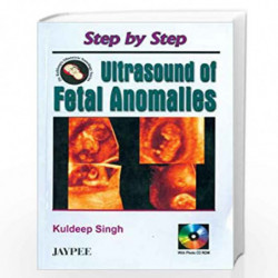 Step by Step Ultrasound of Fetal Anomalies (with Photo CD Rom) by VARGHESE Book-9789350905166