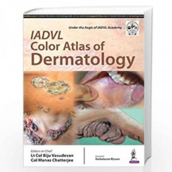 Iadvl Color Atlas Of Dermatology by VASUDEVAM BIJU Book-9789385891212