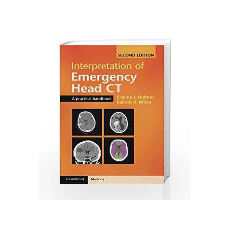 Interpretation of Emergency Head CT: A Practical Handbook by Holmes E J Book-9781107495937