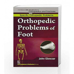 John Ebnezar CBS Handbooks in Orthopedics and Factures: Specific Orthopedic Problems: Orthopedic Problems of Foot by Ebnezar J. 