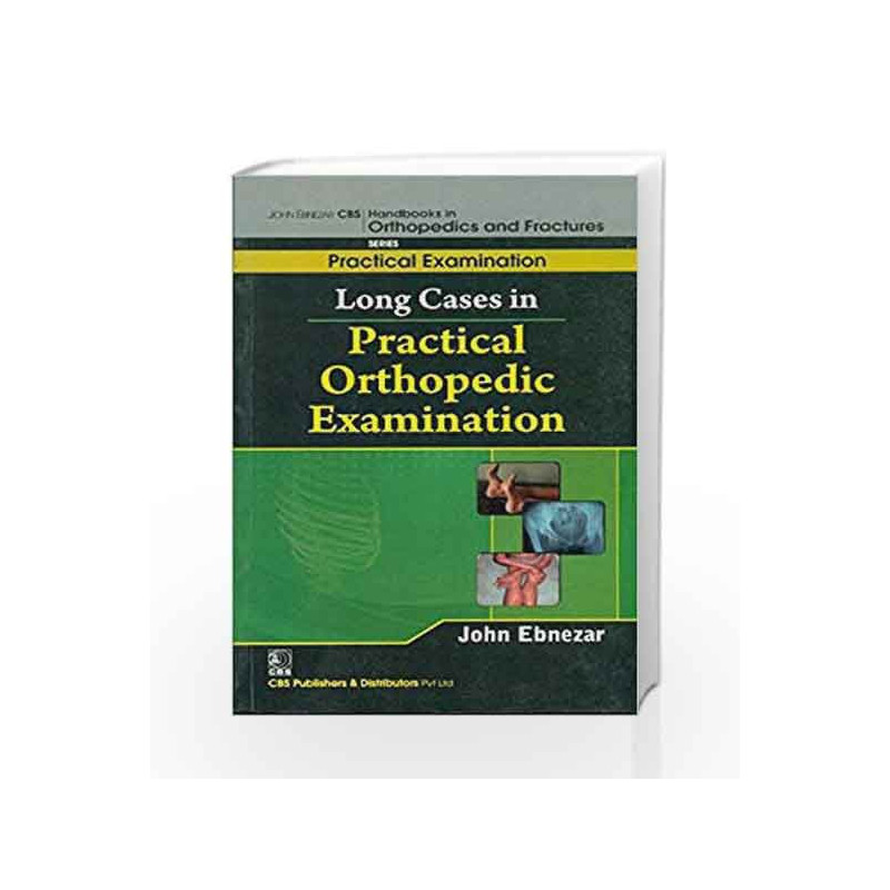 John Ebnezar CBS Handbooks in Orthopedics and Factures: Practical Examination: Long Cases in Practical Orthopedic Examinations b