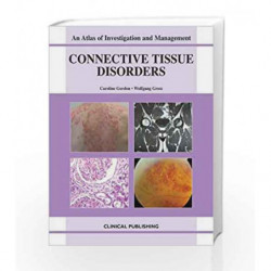 Connective Tissue Diseases (Atlas of Investigation and Management) by Gordon C. Book-9781846920745