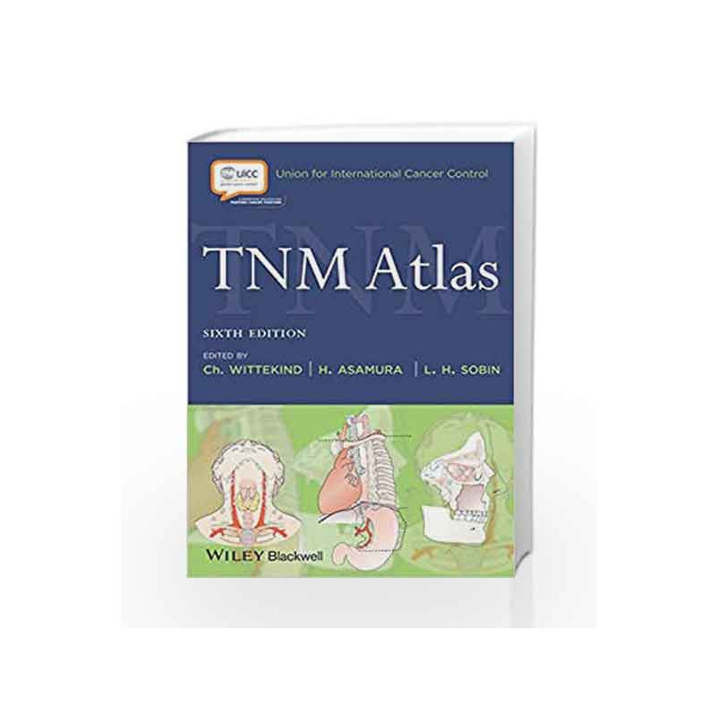 TNM Atlas (Union for International Cancer Control) by Wittekind Book-9781444332421