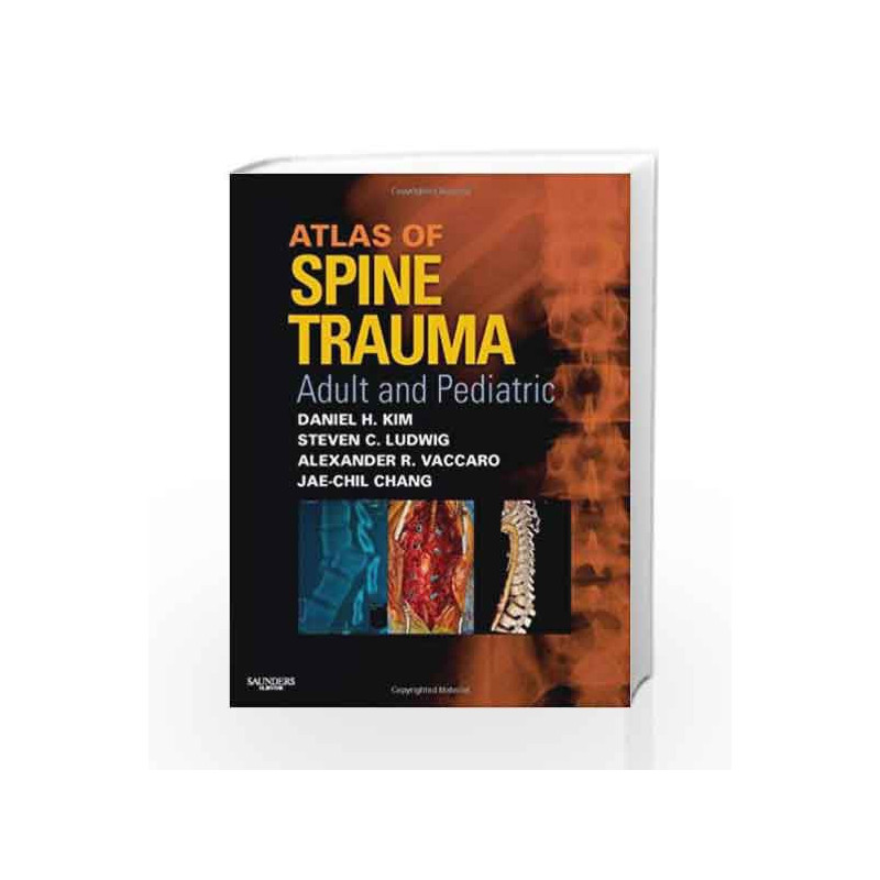 Atlas of Spine Trauma: Adult and Pediatric by Kim Book-9781416034285