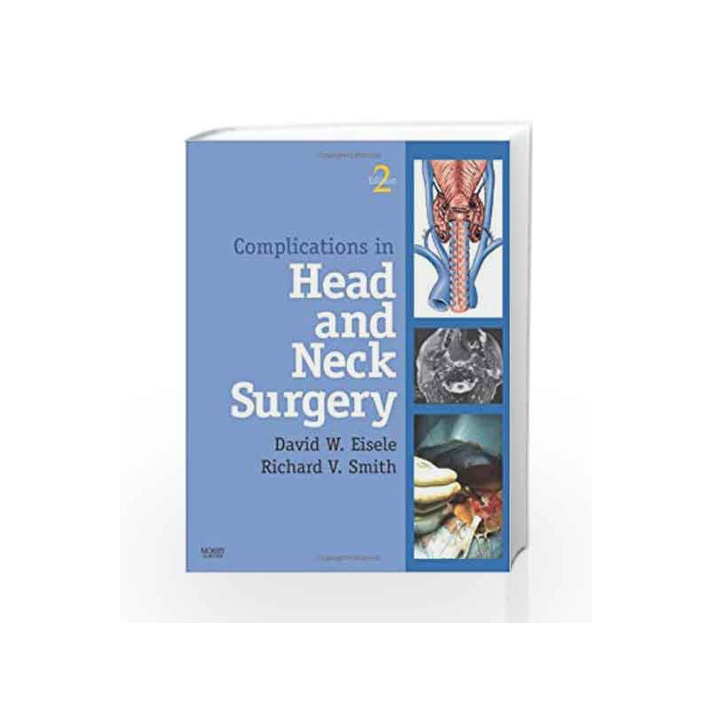Complications in Head and Neck Surgery with CD Image Bank (Book & CD Rom) by Eisele J. Book-9781416042204