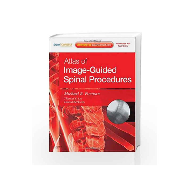 Atlas of Image-Guided Spinal Procedures: Expert Consult - Online and Print by Furman M.B. Book-9780323042994