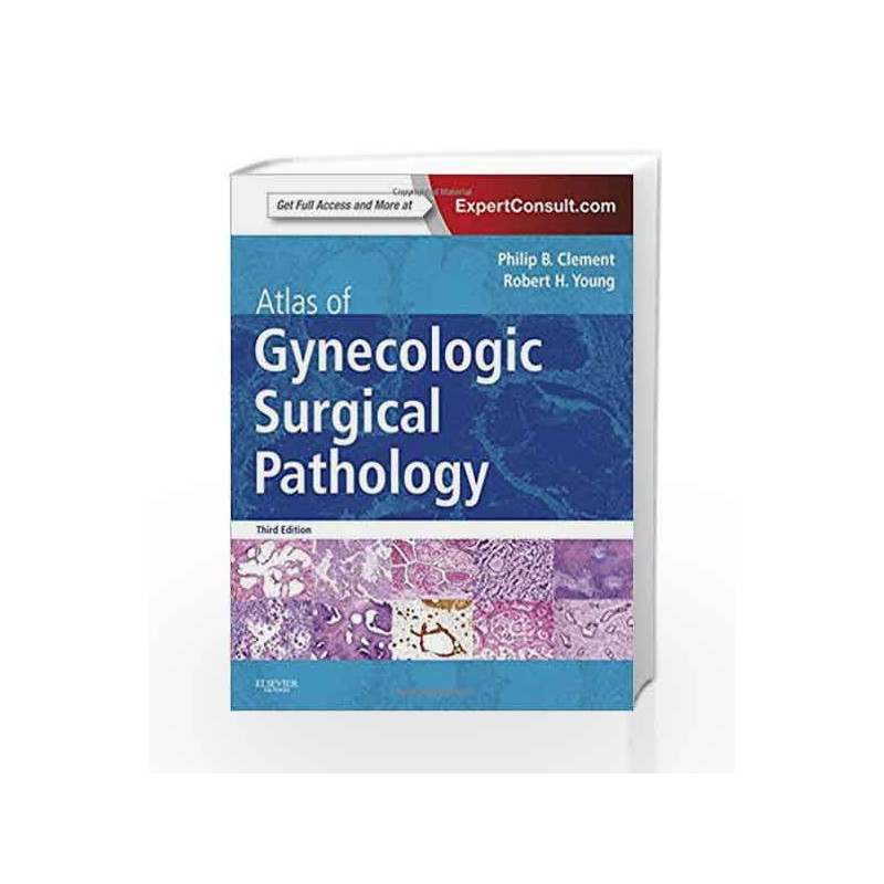 Atlas of Gynecologic Surgical Pathology: Expert Consult: Online and Print by Clement P. B Book-9781455774821