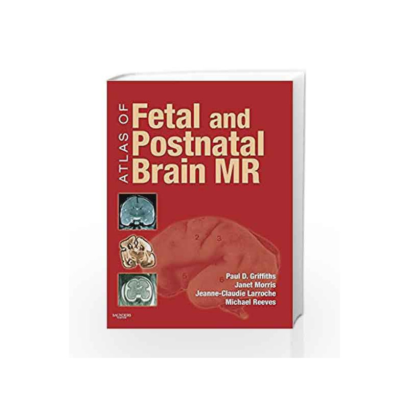 Atlas of Fetal and Postnatal Brain MR by Griffiths Book-9780323052962