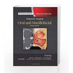 Diagnostic Imaging: Oral and Maxillofacial by Koenig L J Book-9780323477826