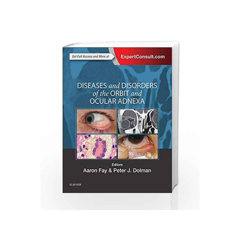 Diseases and Disorders of the Orbit and Ocular Adnexa, 1e by Fay A Book-9780323377232