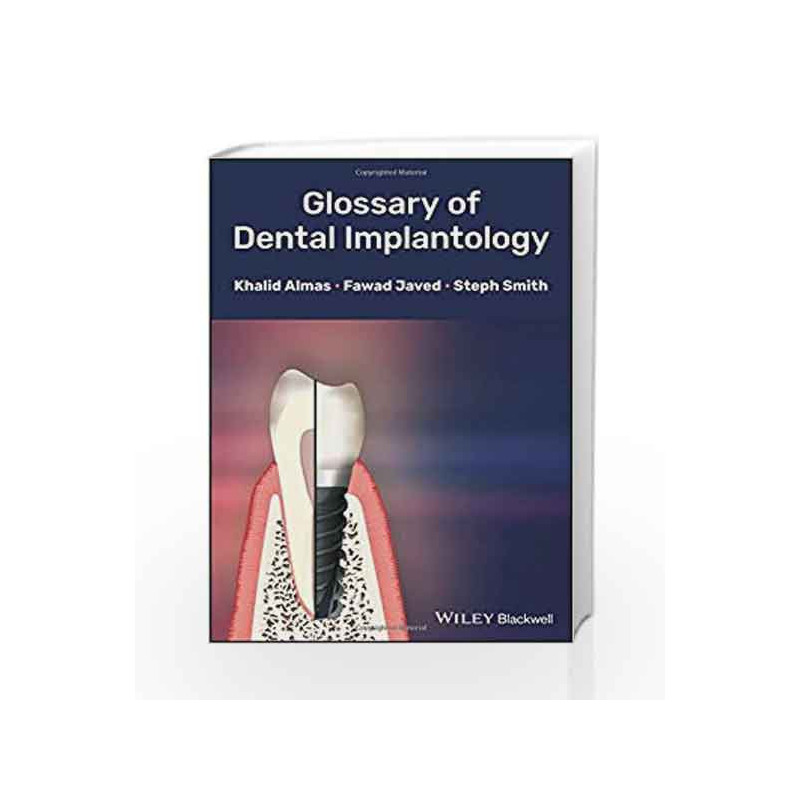 Glossary of Dental Implantology by Almas K Book-9781118626887