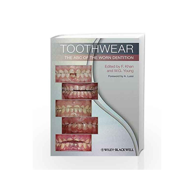 Toothwear: The ABC of the Worn Dentition by Khan F. Book-9781444336559