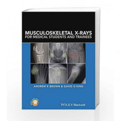 Musculoskeletal XRays for Medical Students and Trainees by Brown A K Book-9781118458730