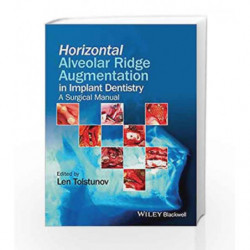 Horizontal Alveolar Ridge Augmentation in Implant Dentistry: A Surgical Manual by Tolstunov L Book-9781119019886