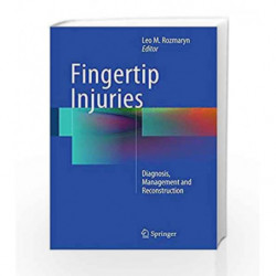 Fingertip Injuries: Diagnosis, Management and Reconstruction by RozmarynL Book-9783319132266