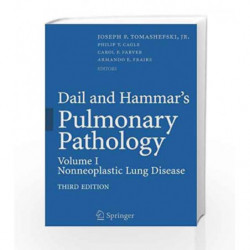 Dail and Hammar's Pulmonary Pathology: Dail and Hammar's Pulmonary Pathology Nonneoplastic Lung Disease Volume I: 1 by Tomashefs