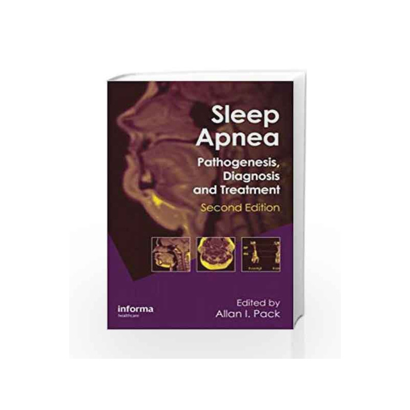 Sleep Apnea: Pathogenesis, Diagnosis and Treatment (Lung Biology in Health and Disease) by Pack A.I. Book-9780849396977