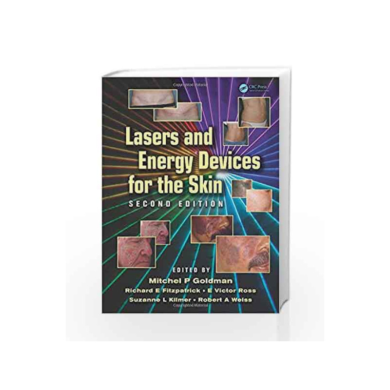 Lasers and Energy Devices for the Skin by Goldman M.P. Book-9781841849331