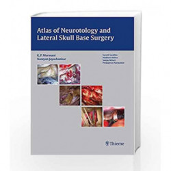 Atlas of Neurotology and Lateral Skull Base Surgery by Morwani Book-9789382076933