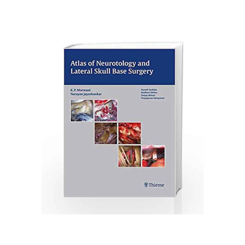 Atlas of Neurotology and Lateral Skull Base Surgery by Morwani Book-9789382076933